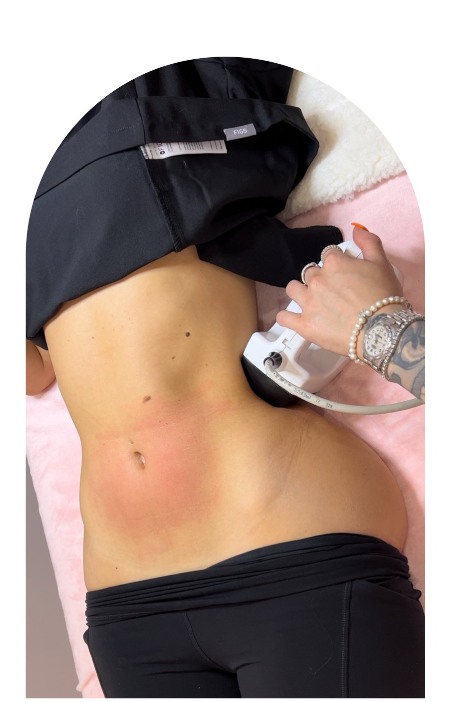 BodyFX Contouring Treatment: The Ultimate Solution for your Body Goals in Vancouver - MY SKIN SPOT