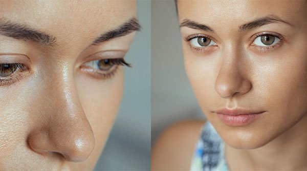 Combination Skin - MY SKIN SPOT