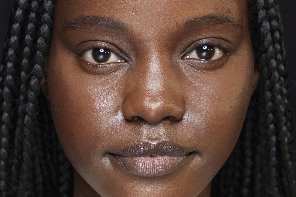 Oily Skin - MY SKIN SPOT