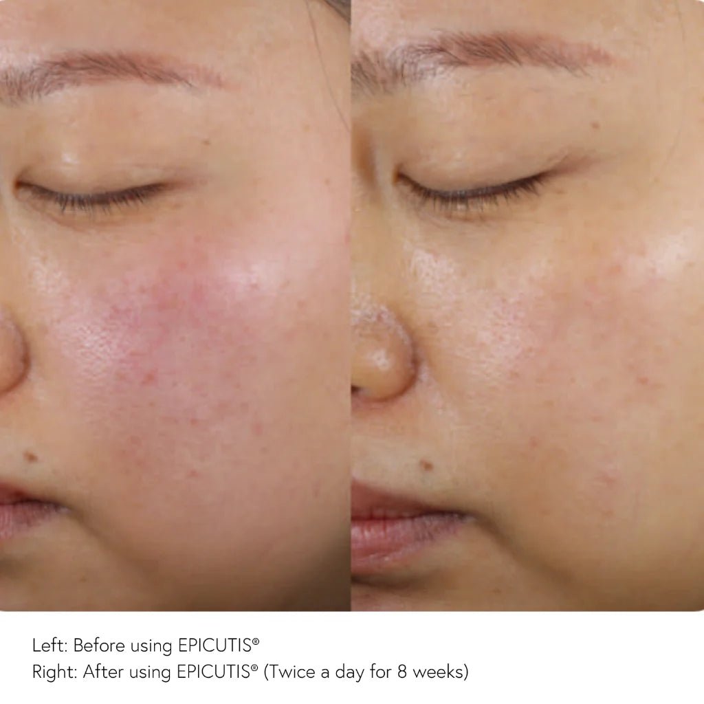 EPICUTIS Arctigenin Brightening Treatment - MY SKIN SPOT