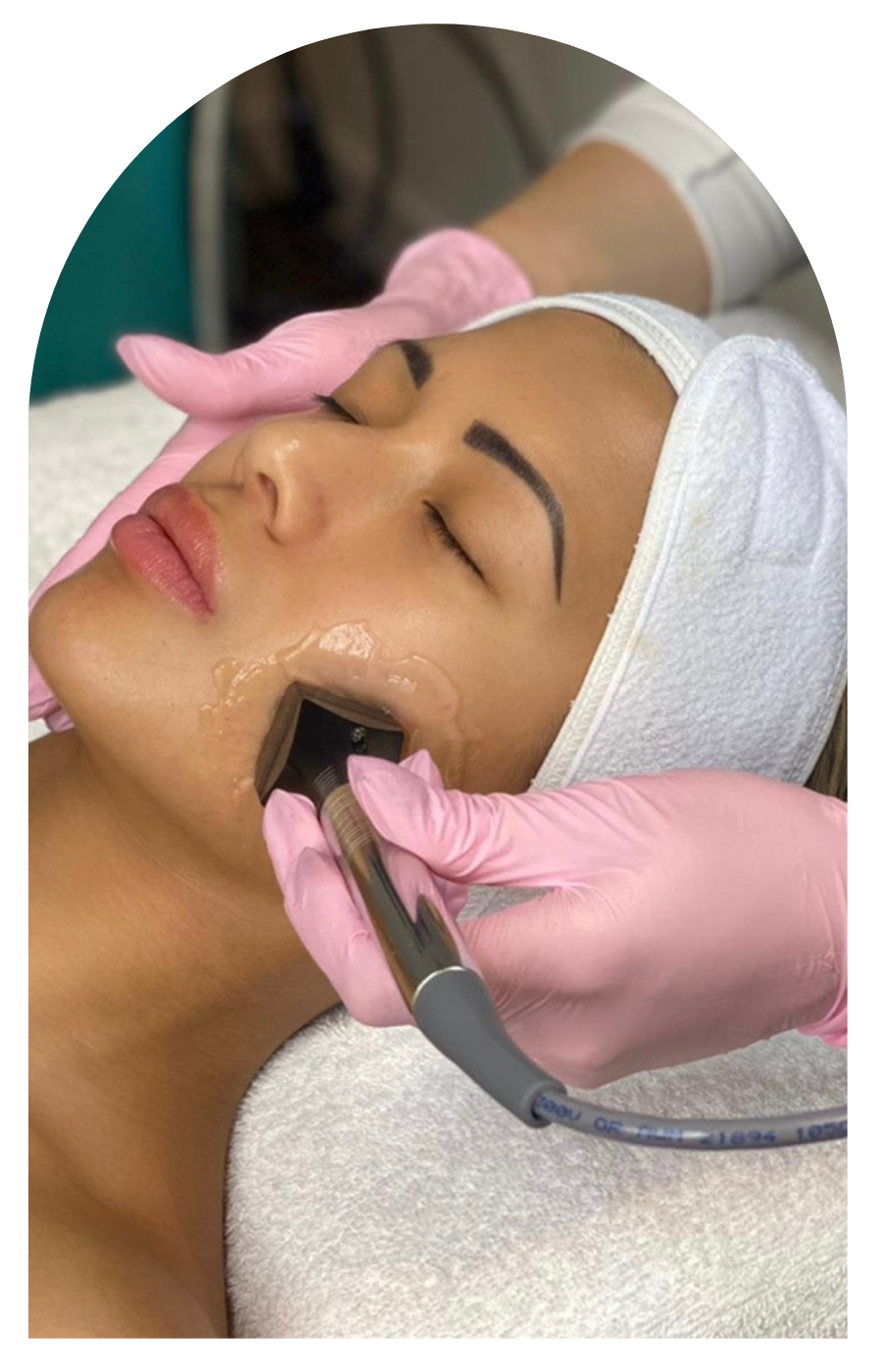 An aesthetician wearing pink gloves performing a Forma radiofrequency (RF) treatment by InMode on a woman’s cheek while she rests on a treatment bed at My Skin Spot medical spa in Vancouver.