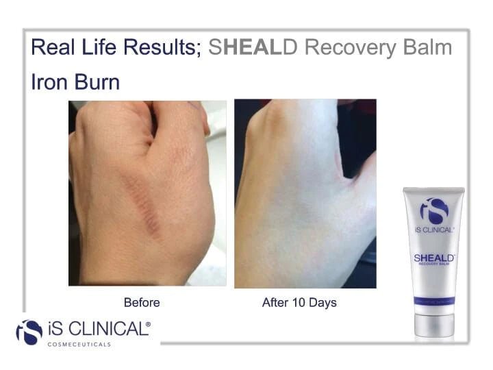 iS CLINICAL Shield Recovery Balm - MY SKIN SPOT