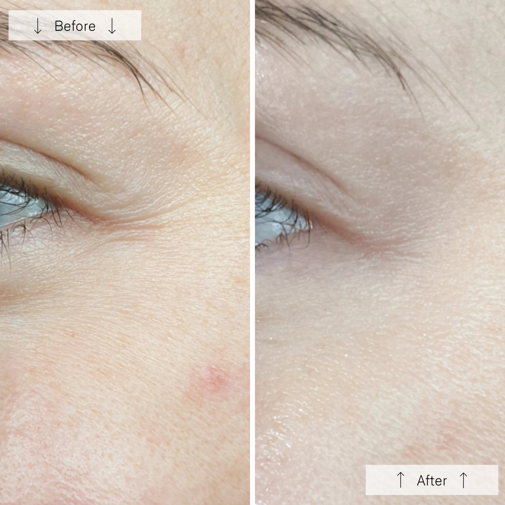OMNILUX Contour Face - MY SKIN SPOT